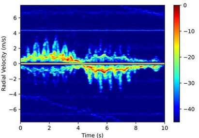 Spectrogram